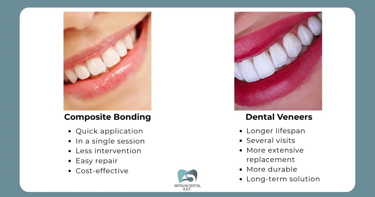 Composite Bonding vs Veneers in Turkey