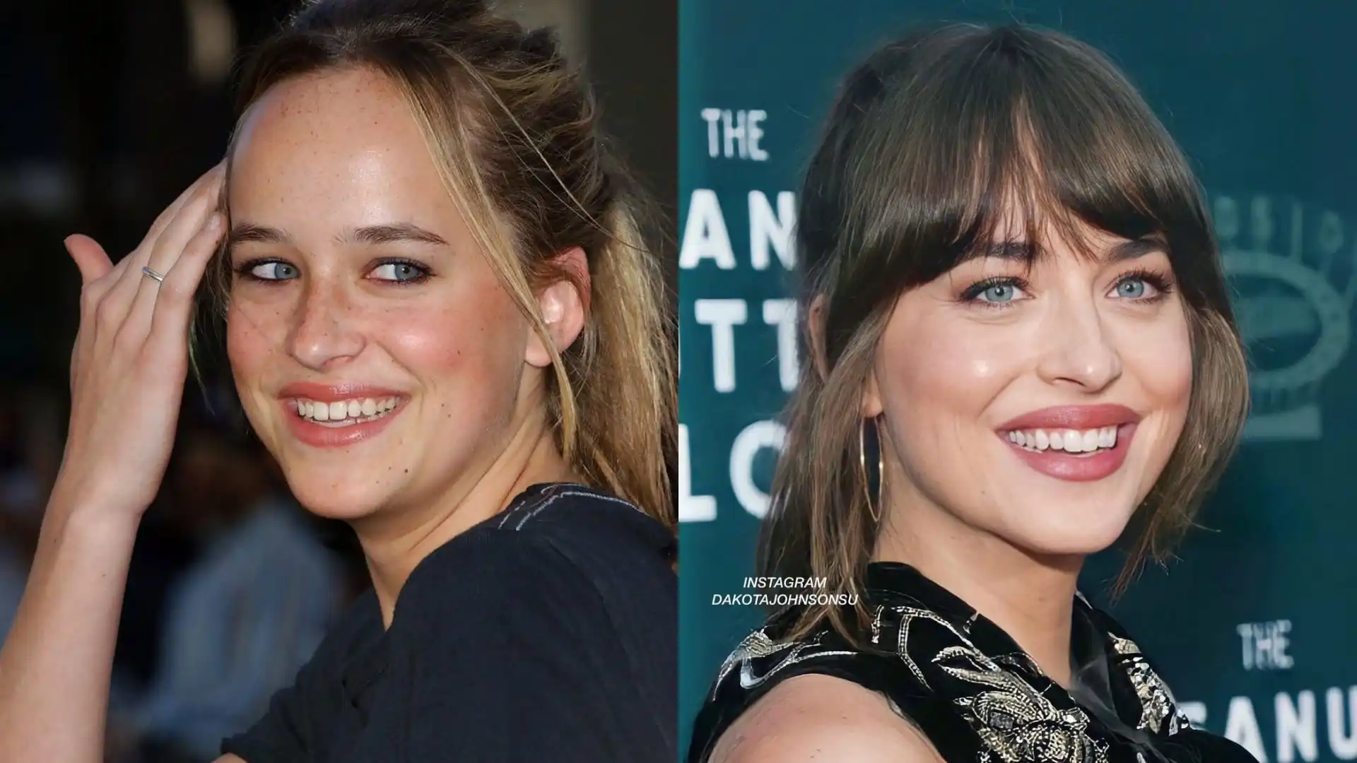 Dakota Johnson’s teeth gap before and after