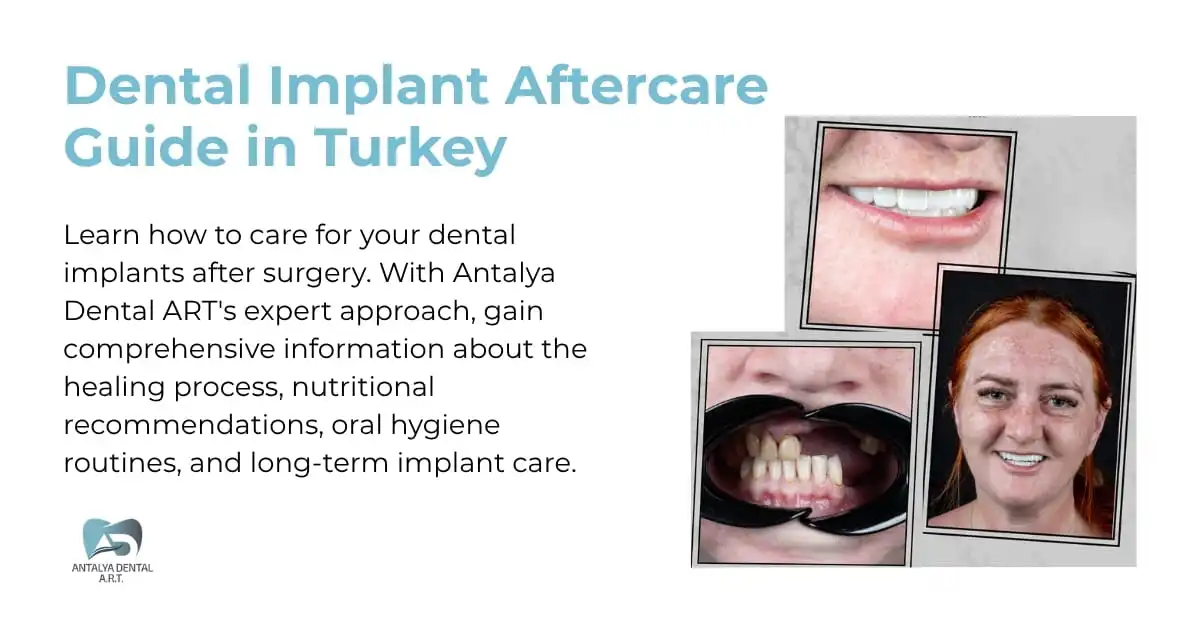 Dental Implant Aftercare Guide in Turkey
