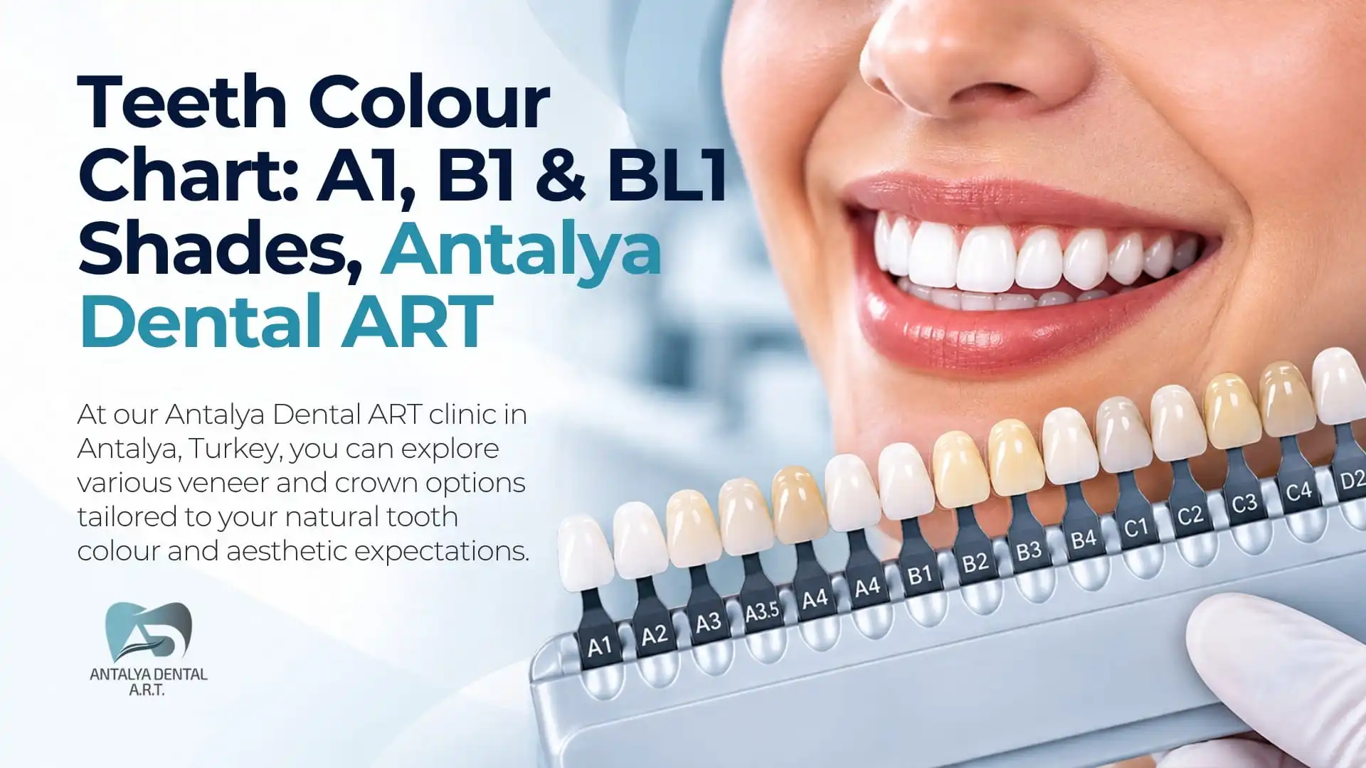 Teeth Colour Chart: A1, B1 & BL1 Shades | Antalya Dental ART